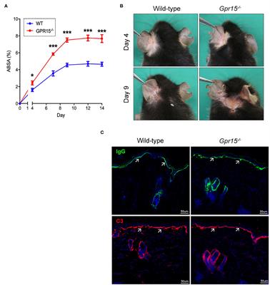 The G Protein-Coupled Receptor (GPR) 15 Counteracts Antibody-Mediated Skin Inflammation